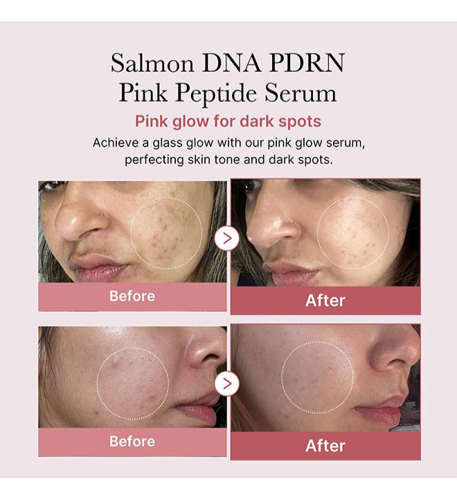 Medicube Salmon DNA PDRN serum for firming and uneven skin tone