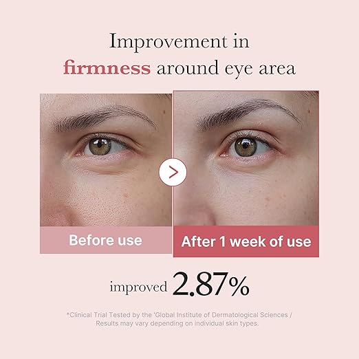 Medicube PDRN Pink Peptide Eye Serum 1.01fl.oz for fine lines, dark circles and puffiness, 