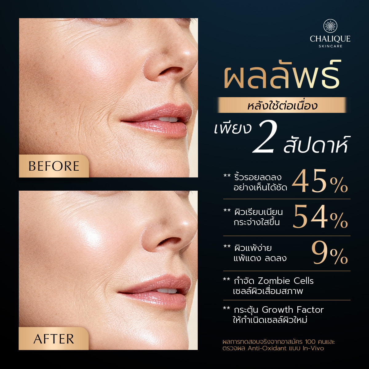 CHALIQUE 12 in 1 Lifting Skin Booster Serum – Hydrating, Firming & Anti-Aging Face Serum
