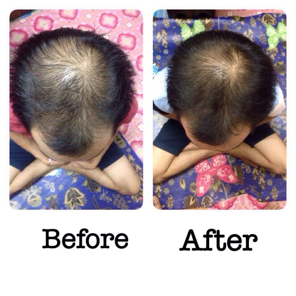 Sensorial Cheveux Hair Growth Serum – 50 ml.Hair CareOrganic Innovative Stimulating Hair Growth and Preventing Hair Loss Product Detail: AnaGainTM, An Organic Innovative Extracts to Rebalance the Hair Life Cycle. Based on sprouts of organic pea, reduces h