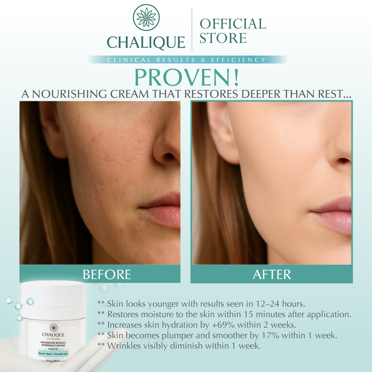 CHALIQUE DreamSkin Bounce Overnight Repair – Overnight Skin Repair & Hydrating Cream