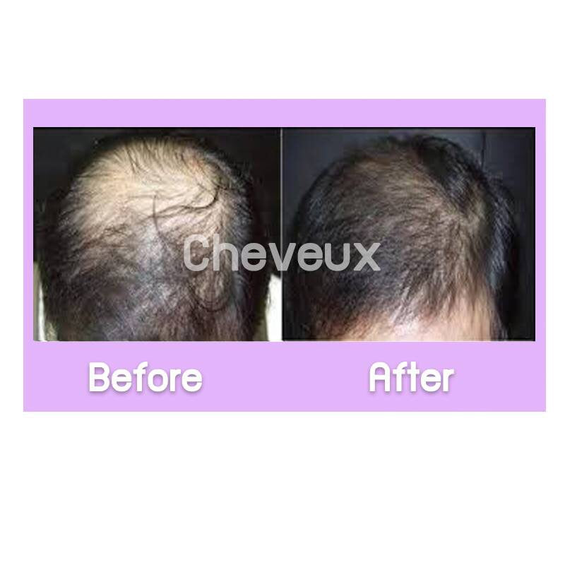 Sensorial Cheveux Hair Growth Serum – 50 ml.Hair CareOrganic Innovative Stimulating Hair Growth and Preventing Hair Loss Product Detail: AnaGainTM, An Organic Innovative Extracts to Rebalance the Hair Life Cycle. Based on sprouts of organic pea, reduces h