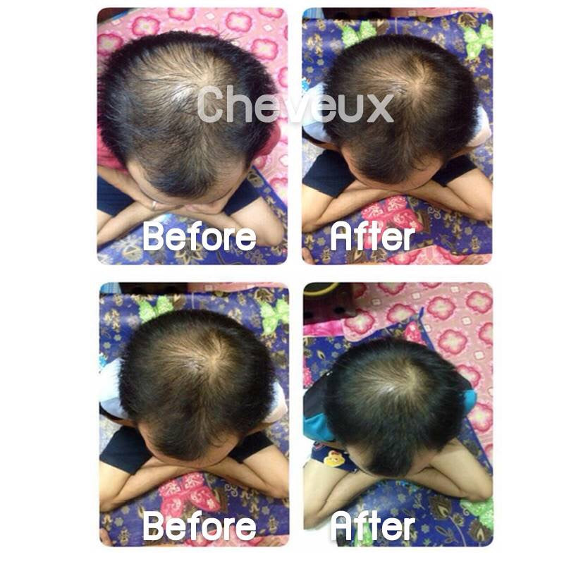 Sensorial Cheveux Hair Growth Serum – 50 ml.Hair CareOrganic Innovative Stimulating Hair Growth and Preventing Hair Loss Product Detail: AnaGainTM, An Organic Innovative Extracts to Rebalance the Hair Life Cycle. Based on sprouts of organic pea, reduces h