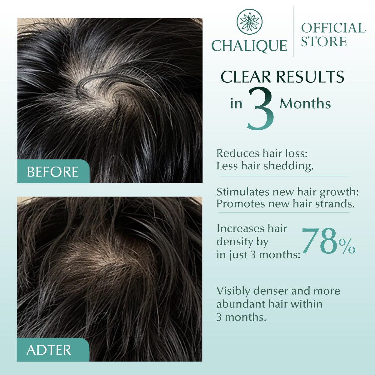 CHALIQUE Hair Fall Control Tonic – Scalp Strengthening & Hair Fall Control Tonic