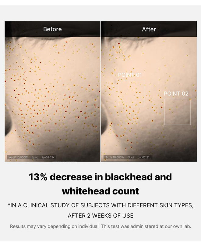 Medicube Zero Pore serum with 2% Niacinamide for smooth skin